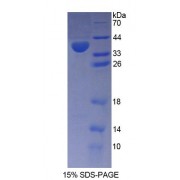 SDS-PAGE analysis of Human PMM1 Protein.