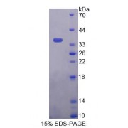 SDS-PAGE analysis of Human PNPO Protein.