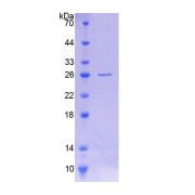 SDS-PAGE analysis of Human POMT1 Protein.