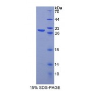 SDS-PAGE analysis of Human PTTG1 Protein.