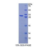 SDS-PAGE analysis of Human PTTG1 Protein.