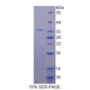 SDS-PAGE analysis of Human RSU1 Protein.