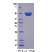 SDS-PAGE analysis of Human RTKN Protein.