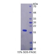 SDS-PAGE analysis of Human TIAM1 Protein.