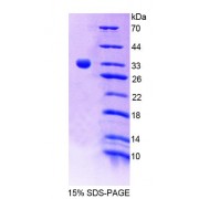 SDS-PAGE analysis of Human TESK1 Protein.