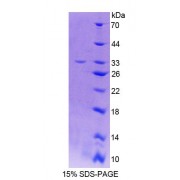 SDS-PAGE analysis of Rat THYN1 Protein.