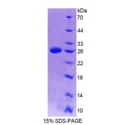 SDS-PAGE analysis of Mouse TMEM1 Protein.