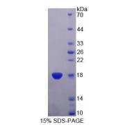 SDS-PAGE analysis of Human TRAPPC2 Protein.