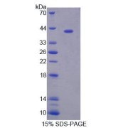 SDS-PAGE analysis of Human TSTA3 Protein.