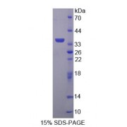 SDS-PAGE analysis of Human TP Protein.