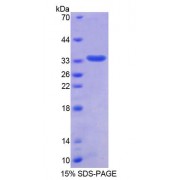 SDS-PAGE analysis of Human TMPO Protein.