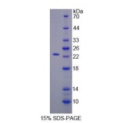 SDS-PAGE analysis of Human SCEL Protein.