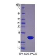 SDS-PAGE analysis of Human SCP2 Protein.