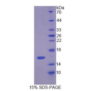 SDS-PAGE analysis of Rat SCP2 Protein.