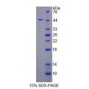 SDS-PAGE analysis of Rat SKAP1 Protein.