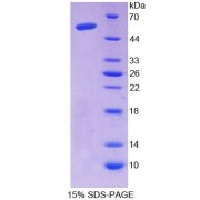 SDS-PAGE analysis of Human AASS Protein.