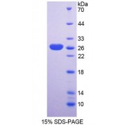 SDS-PAGE analysis of Mouse SNAG1 Protein.
