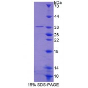 SDS-PAGE analysis of Human SPIN1 Protein.