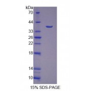 SDS-PAGE analysis of Human SSRa Protein.