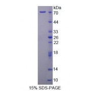 SDS-PAGE analysis of Rat STAM2 Protein.