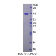 SDS-PAGE analysis of Human SYMPK Protein.