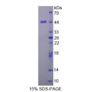 SDS-PAGE analysis of Human DHPS Protein.