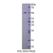 SDS-PAGE analysis of Mouse DHPS Protein.
