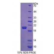 SDS-PAGE analysis of Human FGF22 Protein.
