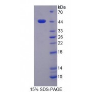 SDS-PAGE analysis of Human gABBR1 Protein.
