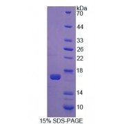 SDS-PAGE analysis of Rat CNR1 Protein.