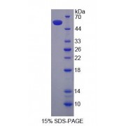 SDS-PAGE analysis of Human CLTA Protein.