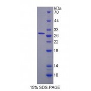 SDS-PAGE analysis of Mouse CLTA Protein.
