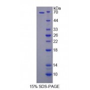 SDS-PAGE analysis of Human APBB2 Protein.
