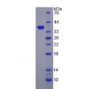 SDS-PAGE analysis of Human CAPN9 Protein.
