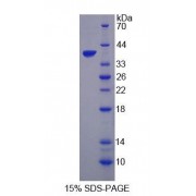 SDS-PAGE analysis of Human CTSH Protein.