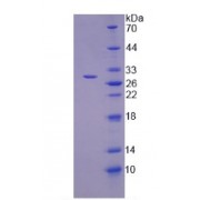 SDS-PAGE analysis of Human TNKS2 Protein.