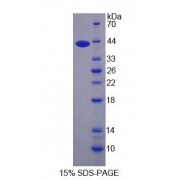 SDS-PAGE analysis of Human NARS Protein.