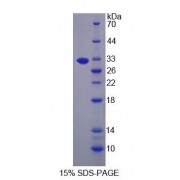SDS-PAGE analysis of Human LARS Protein.