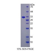 SDS-PAGE analysis of Human LARS Protein.