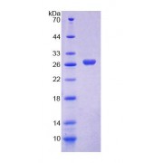 SDS-PAGE analysis of Rat QARS Protein.
