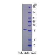 SDS-PAGE analysis of Human DARS Protein.