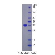 SDS-PAGE analysis of Rat LCN13 Protein.