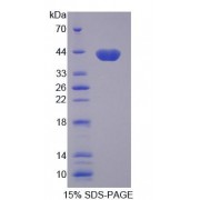 SDS-PAGE analysis of Human AQP8 Protein.