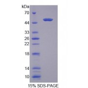 SDS-PAGE analysis of recombinant Mouse TRDN Protein.