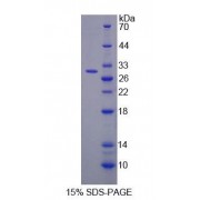 SDS-PAGE analysis of Rat TRDN Protein.