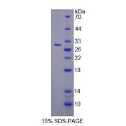 SDS-PAGE analysis of Rat TRDN Protein.