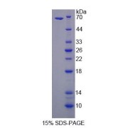 SDS-PAGE analysis of Rat NSMASE Protein.