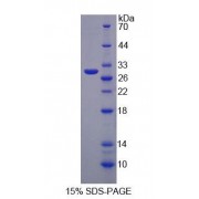SDS-PAGE analysis of Human MPP3 Protein.