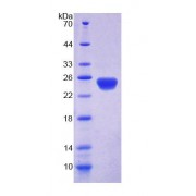SDS-PAGE analysis of Human DLG5 Protein.