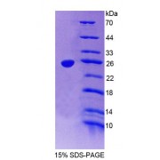 SDS-PAGE analysis of Mouse DLG5 Protein.